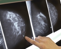Beruházás egy még korszerűbb diagnosztizálás érdekében